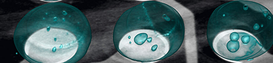 3d ct scan bga cheetah evo yxlon accelonix